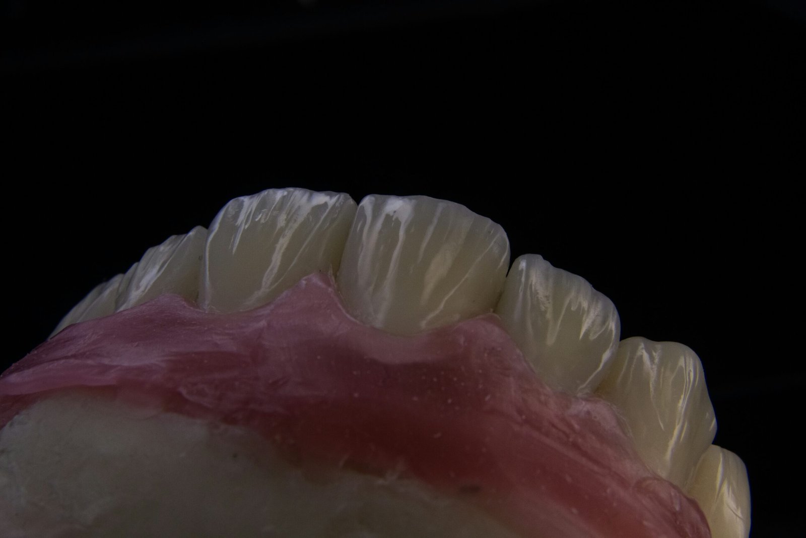 Full Arch Zirconia Bridge: Restoring Your Entire Smile